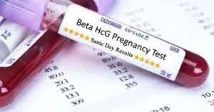 میزان hcg در آزمایش بارداری
