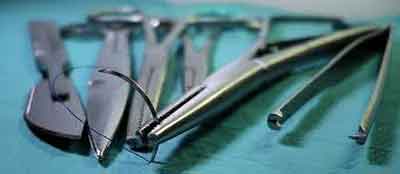 is hymenoplasty successful
