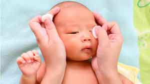 درمان ترشحات زرد رنگ چشم نوزادان 