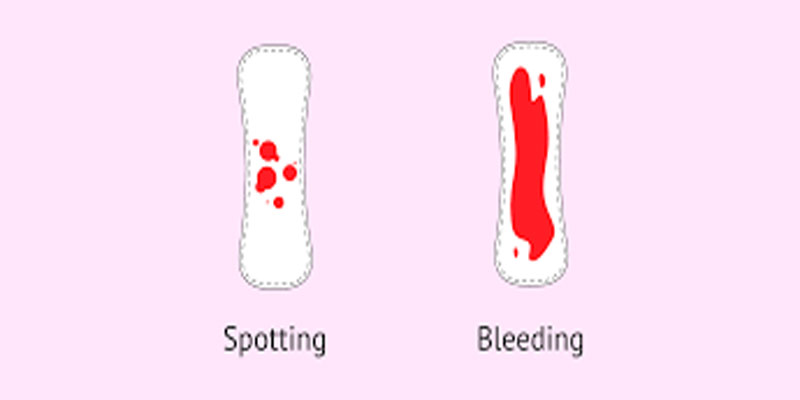 چه چیزهایی باعث خونریزی در بارداری میشود